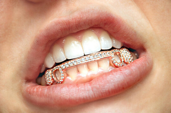 Relocatable Online Tooth Jewellery Business for Sale Brisbane Relocatable